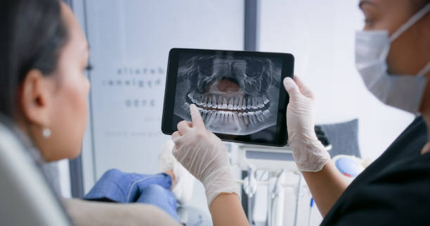 Licensed Tooth Extraction service in Hillsborough, CA - Smile Center Dentistry